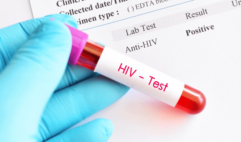 Hiểu rõ các phương pháp xét nghiệm HIV: Kiến thức quan trọng về sức khỏe cần nắm! 4