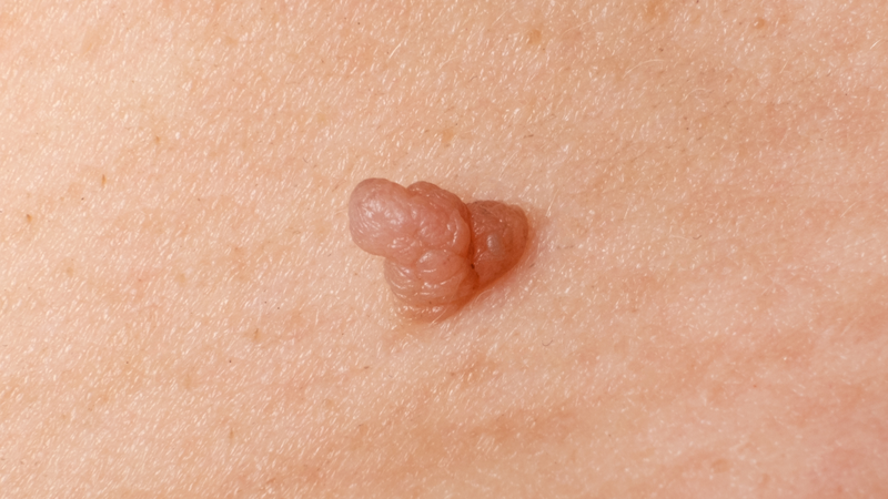 Hiểu về các dấu hiệu lão hóa da để sống vui khỏe mỗi ngày 3