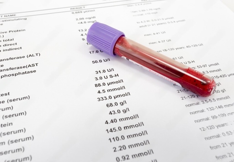 Hiểu về cách đọc kết quả xét nghiệm Double Test: Những điều cha mẹ cần biết 1