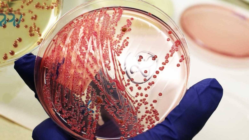 Hiểu về xét nghiệm cấy máu trong nhiễm khuẩn huyết 1