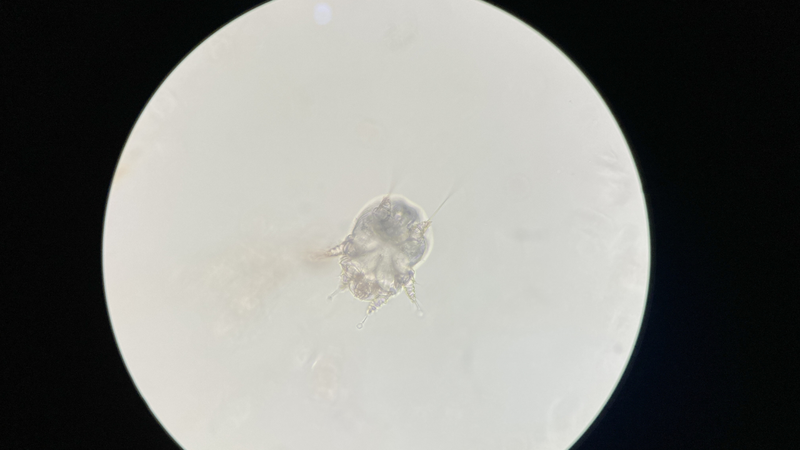 Cái ghẻ xâm nhập vào da tạo thành những đường hầm nhỏ li ti