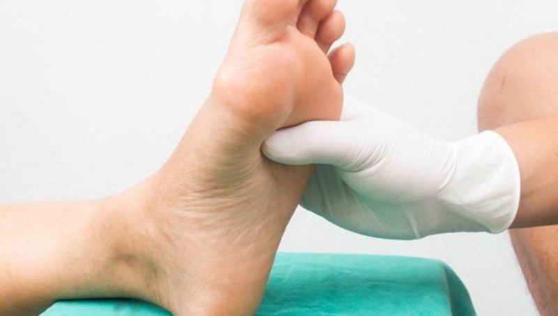 Hình ảnh bong gân bàn chân chi tiết nhất và cách điều trị 2