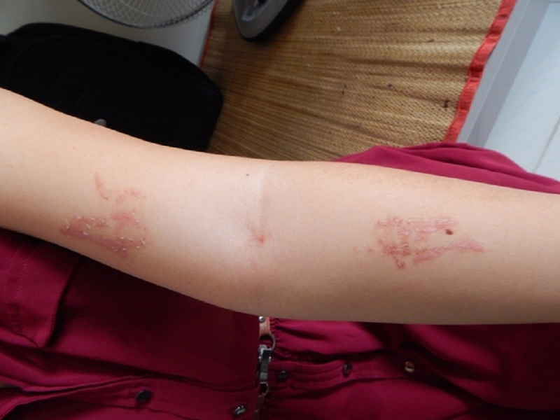 Hình ảnh kiến ba khoang: Cách nhận biết và phòng tránh 2