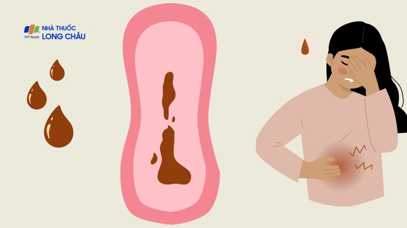 Hình ảnh máu kinh nguyệt thường thấy nói lên điều gì?2