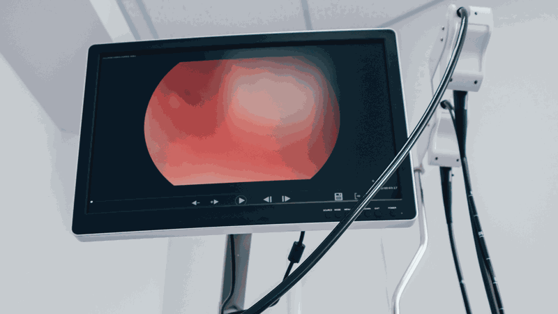 Hình ảnh nội soi dạ dày bình thường