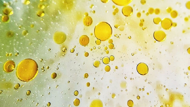 Hình ảnh nước tiểu có váng mỡ: Nguyên nhân, dấu hiệu và cách điều trị 1