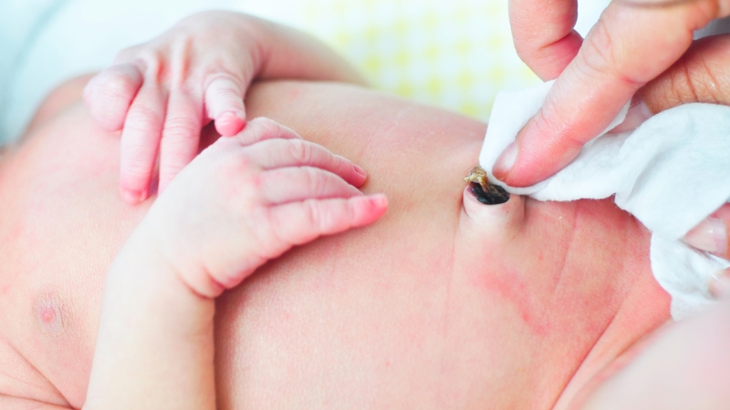 Vệ sinh rốn sai cách có thể tạo điều kiện cho vi khuẩn xâm nhập và phát triển tại cuống rốn