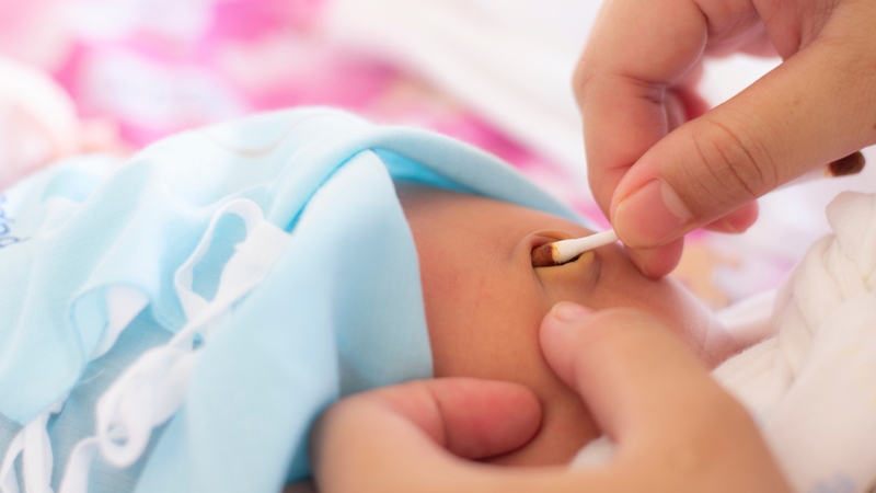 Vùng rốn cần được giữ khô, sạch và vệ sinh bằng dung dịch sát khuẩn theo hướng dẫn chuyên môn