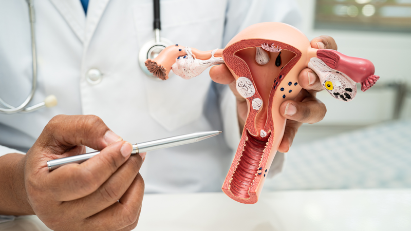 Hình ảnh sa tử cung độ 1: Dấu hiệu nhận biết và cách trị 3
