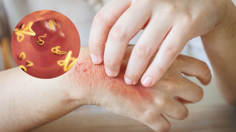 Hình ảnh sán chó và dấu hiệu nhận biết cần lưu ý 1