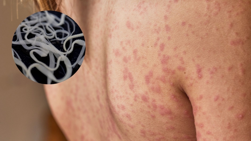 Hình ảnh sán chó và dấu hiệu nhận biết cần lưu ý 2