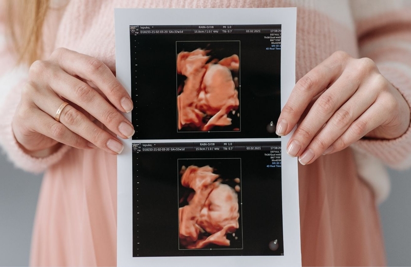 Hình ảnh siêu âm 4D giúp cha mẹ lưu giữ khoảnh khắc đáng nhớ trong thai kỳ