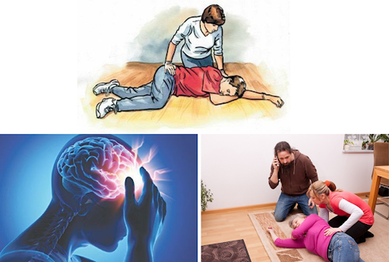 Hướng dẫn các bước hình ảnh sơ cứu đột quỵ tại chỗ mà bạn nên biết