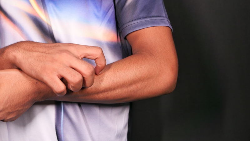 Hình ảnh sốt phát ban và sởi: Phân biệt chính xác để điều trị hiệu quả 2