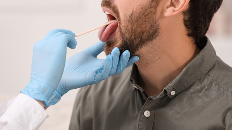 Hình ảnh ung thư khoang miệng giai đoạn đầu: Dấu hiệu nhận biết sớm và cách phòng ngừa 6