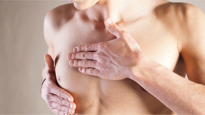 Hình ảnh ung thư vú giai đoạn đầu ở nam và nữ 2