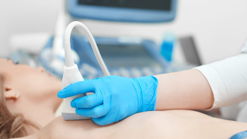 Hình ảnh ung thư vú giai đoạn đầu ở nam và nữ 5