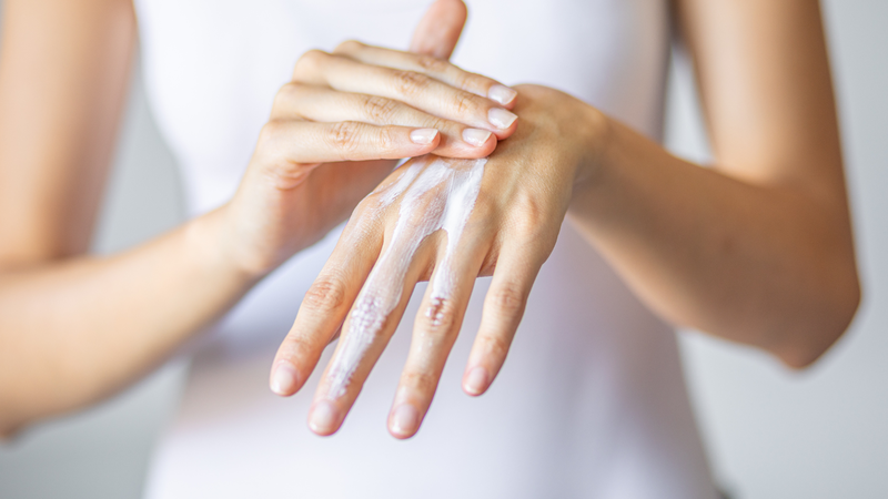 Hình ảnh viêm da cơ địa người lớn: Nguyên nhân và cách điều trị 10