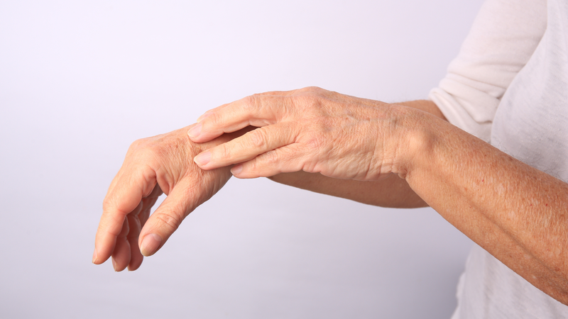 Hình ảnh viêm da cơ địa người lớn: Nguyên nhân và cách điều trị 8