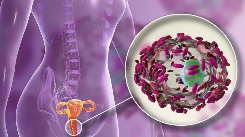 Hình ảnh viêm phụ khoa ở nữ và cách phòng ngừa 2