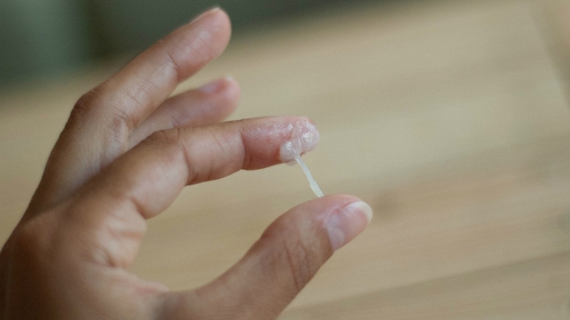 Hình ảnh viêm phụ khoa ở nữ và cách phòng ngừa 9