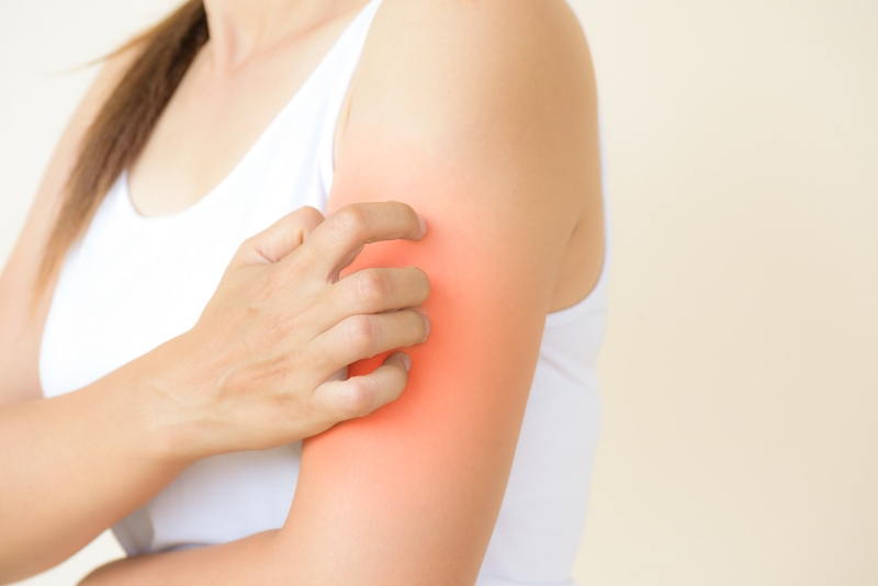 Histamin có trong thực phẩm nào? Cần lưu ý gì khi dùng thực phẩm này 2