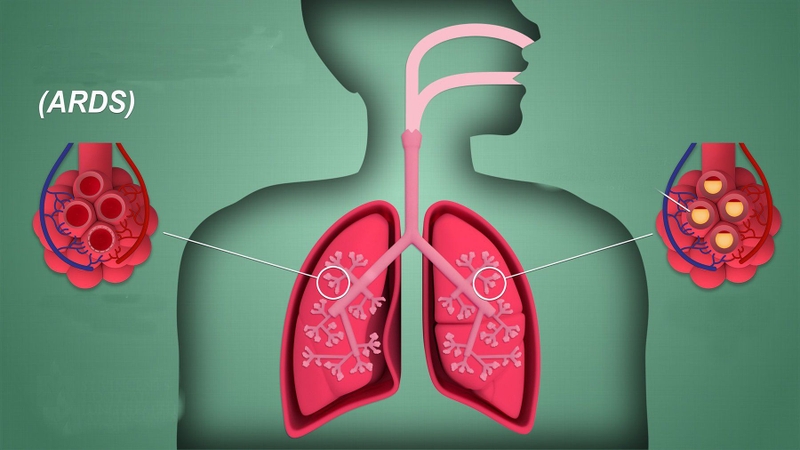 hit-tho-oxygen-nguyen-chat-co-loi-hay-hai-cho-co-the 4