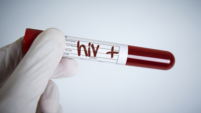 HIV gây suy giảm hệ miễn dịch