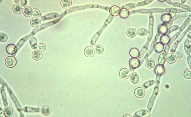 HIV là gì? HIV giai đoạn cuối sống được bao lâu? 2