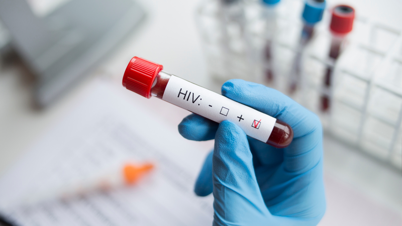 HIV lây qua đường nào? Cách phòng ngừa lây nhiễm HIV/AIDS 1