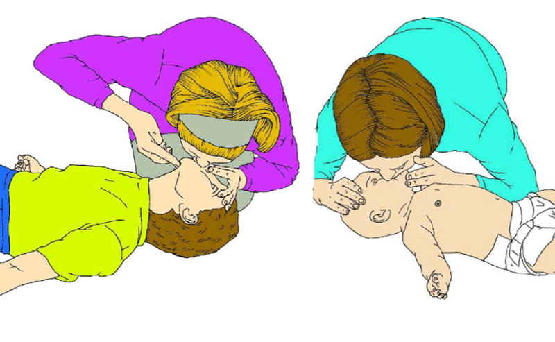 Hô hấp nhân tạo là biện pháp hỗ trợ hô hấp cho bệnh nhân