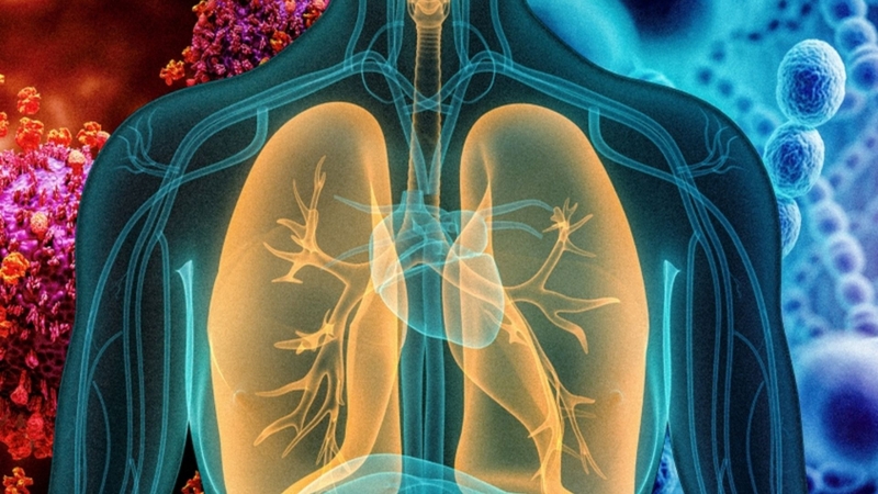 Viêm phổi có thể là nguyên nhân dẫn đến ho nhiều