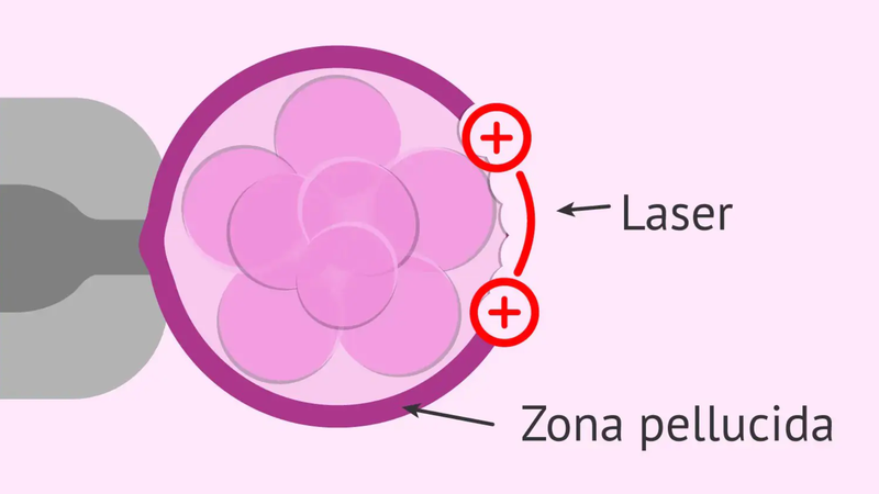 Hỗ trợ phôi thoát màng là gì? 1