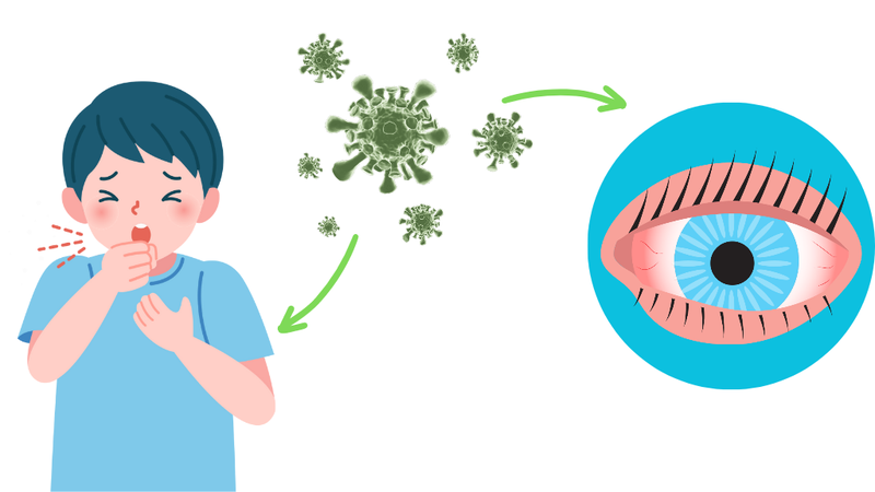 ho-va-dau-mat-do-nguyen-nhan-va-cach-phong-ngua 1