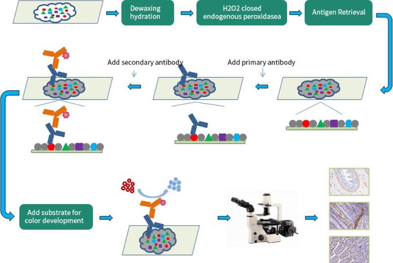 Hóa mô miễn dịch là gì? Cách đọc kết quả hóa mô miễn dịch 3