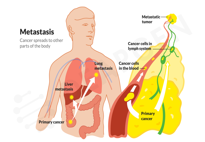 Hóa mô miễn dịch là gì? Cách đọc kết quả hóa mô miễn dịch 4