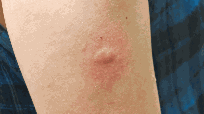 Hoa thanh long ăn được không? 3