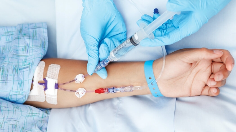 Hóa xạ trị đồng thời: Lợi ích trong điều trị ung thư và tác dụng phụ 1