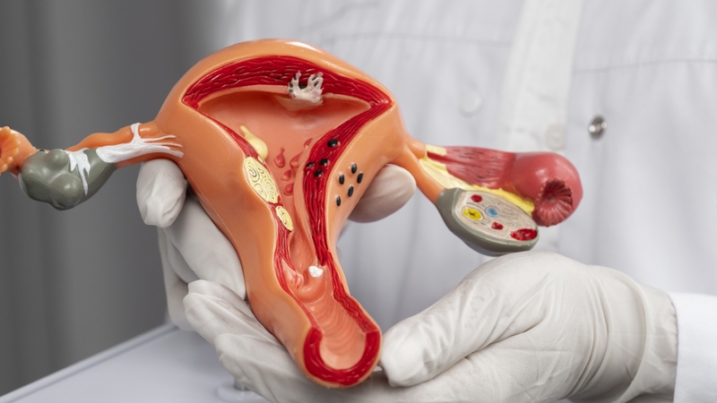 hoang-the-corpus-luteum-la-gi 1