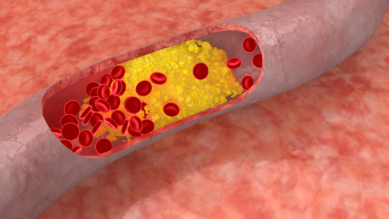 Hoạt chất Evolocumab có tác dụng gì? Hỗ trợ điều trị tăng cholesterol máu gia đình
