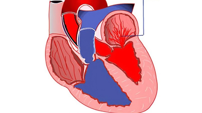 Hohl nhẹ là gì? Hiểu rõ về tình trạng hở van hai lá nhẹ 2