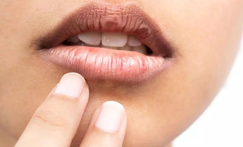 Hiểu về hội chứng Sjögren: Nguyên nhân, triệu chứng và cách điều trị hiệu quả 2