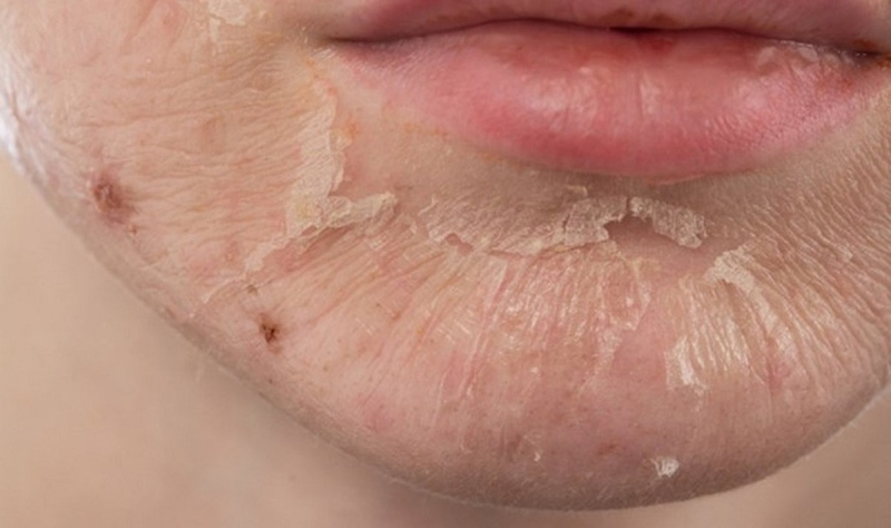 hoi-chung-bong-da-do-tu-cau-nhung-dieu-can-biet 1.jpg