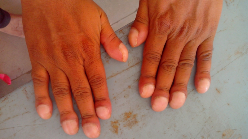 hoi-chung-can-u 5.jpg