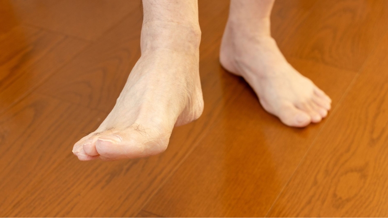 Hiện nay chưa rõ nguyên nhân trực tiếp gây hội chứng chân không yên