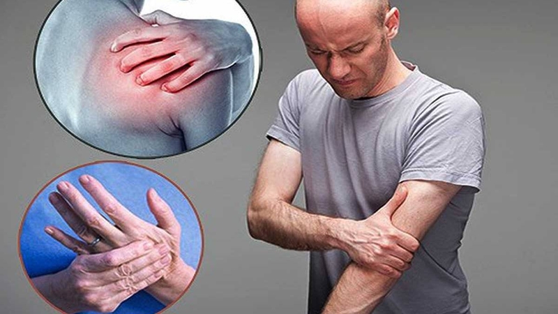 Những điều cần biết về hội chứng cổ vai cánh tay 1