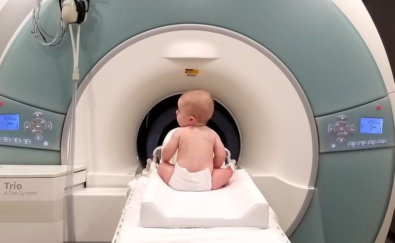 Hội chứng Crouzon là gì? Nguyên nhân và triệu chứng của bệnh 3