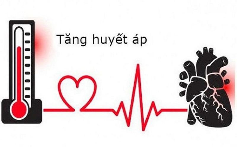 Hội chứng cung động mạch chủ là gì? Bao gồm những dạng bệnh lý nào? 1