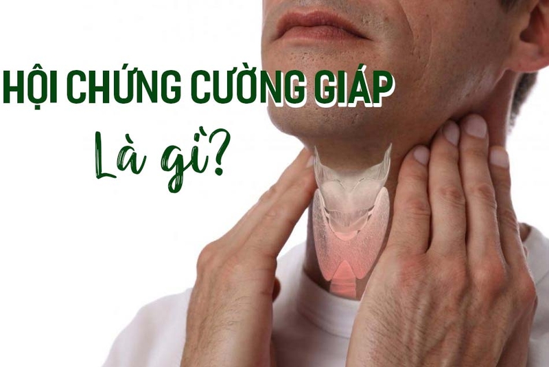 Triệu chứng cường giáp và cách phòng tránh bệnh hiệu quả 1