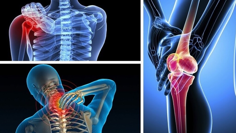 Hội chứng đau cân cơ: Dấu hiệu nhận biết, chẩn đoán và điều trị 1